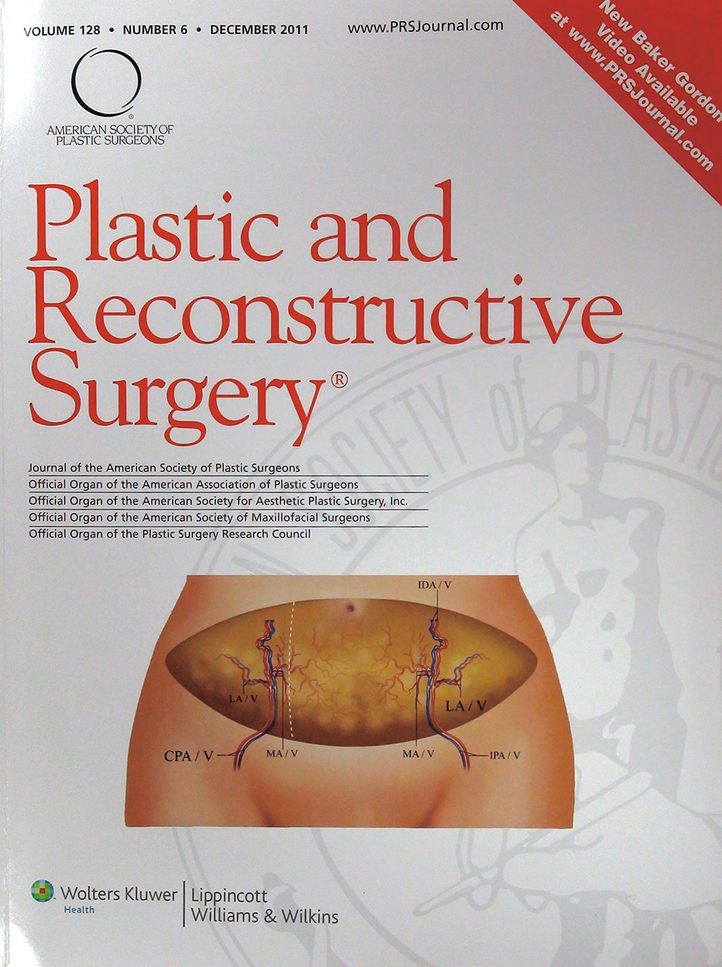 Simultaneous scarless contralateral breast augmentation during unilateral breast reconstruction using bilateral differentially split DIEP flaps